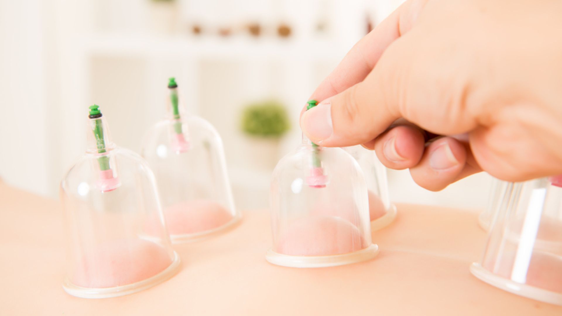 Hijama Therapy